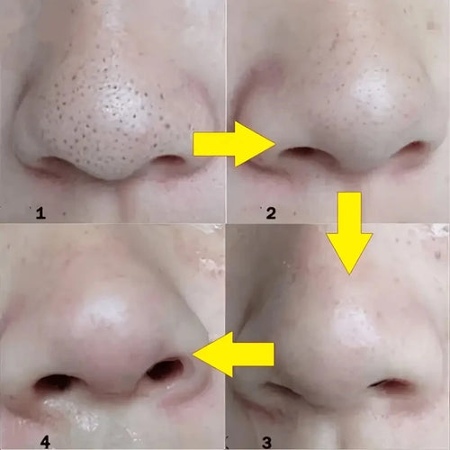 Charcoal Nose Strip Cleanse